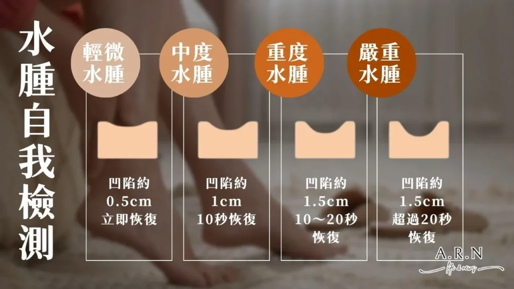 水腫怎麼辦